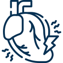 Tratamiento cardiaco en puebla